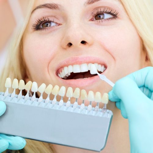 Wilsonville Dental Group - Teeth Whitening